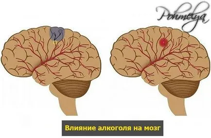 Как алкохол влияе на мозъка