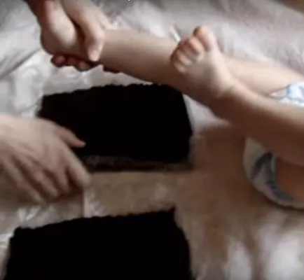 Eltávolítása a lábak gipertonus egy gyerek egy év után a masszázs és a gyakorlatok