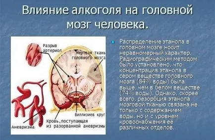 Как алкохол върху мозъка и неговия ефект върху невроните