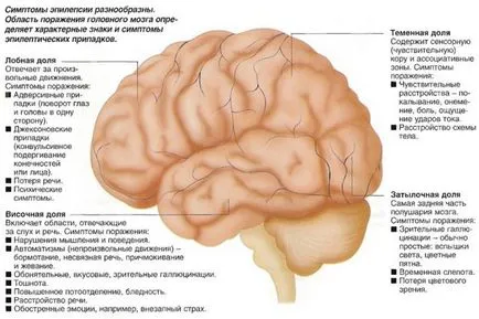 Класификация и видове форми на епилепсия изземване и симптоми при възрастни и деца