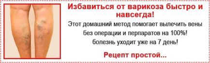 варикозни вени лечение в ранните етапи и ранните симптоми на разширени вени