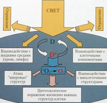 Милон лазер