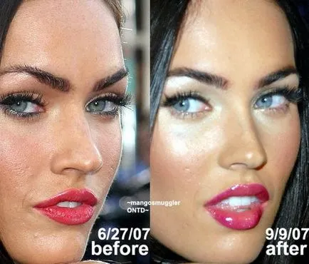 Megan Fox - chirurgie plastica înainte și după (foto)