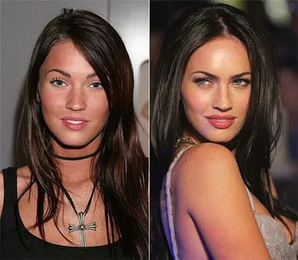 Megan Fox - chirurgie plastica înainte și după (foto)