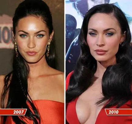 Megan Fox - chirurgie plastica înainte și după (foto)