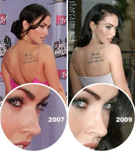 Megan Fox - plasztikai sebészet előtt és után (fotó)