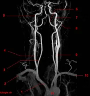 MRI nyaki erek árakat MR angiográfia a nyaki erek