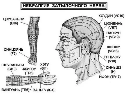 Невралгия тилната нервни симптоми, лечение