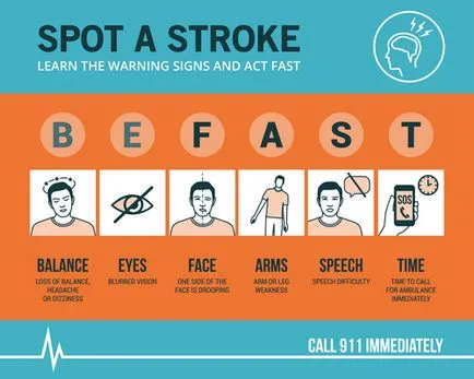 Primele semne de accident vascular cerebral la bărbați și femei