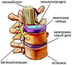 segmentul vertebral-motor (PDS coloanei vertebrale) - n - Centrul medical sistematic 