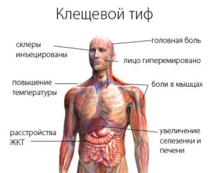 Tünetei a kullancscsípés egy emberi test jelei és következményei