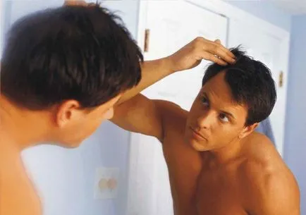 Az orvosság hajhullás a férfiak otthon vélemények
