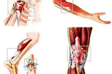 Тендинит в коляното, рамото, крака и китката симптоми и лечение
