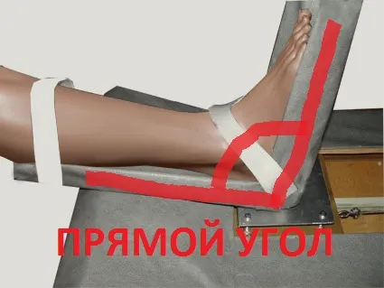 Leg инсулт shagonog 409