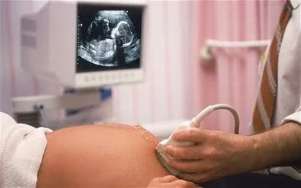 Третият прожекцията по време на бременност е възможно, показатели и честота