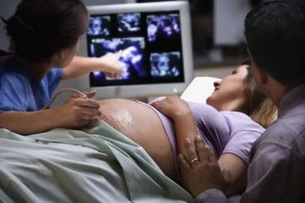 Третият прожекцията по време на бременност е възможно, показатели и честота