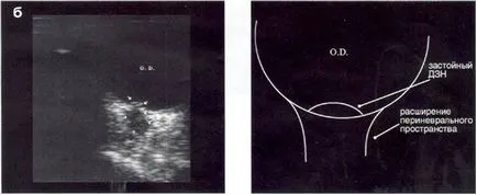 Ultrahang diagnosztika betegségek a látóideg