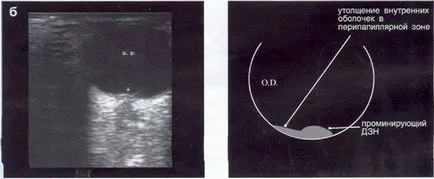 Ultrahang diagnosztika betegségek a látóideg