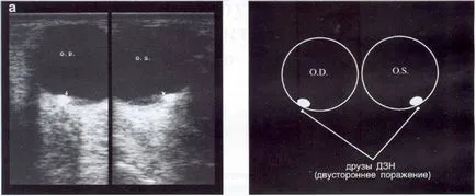 Ultrahang diagnosztika betegségek a látóideg