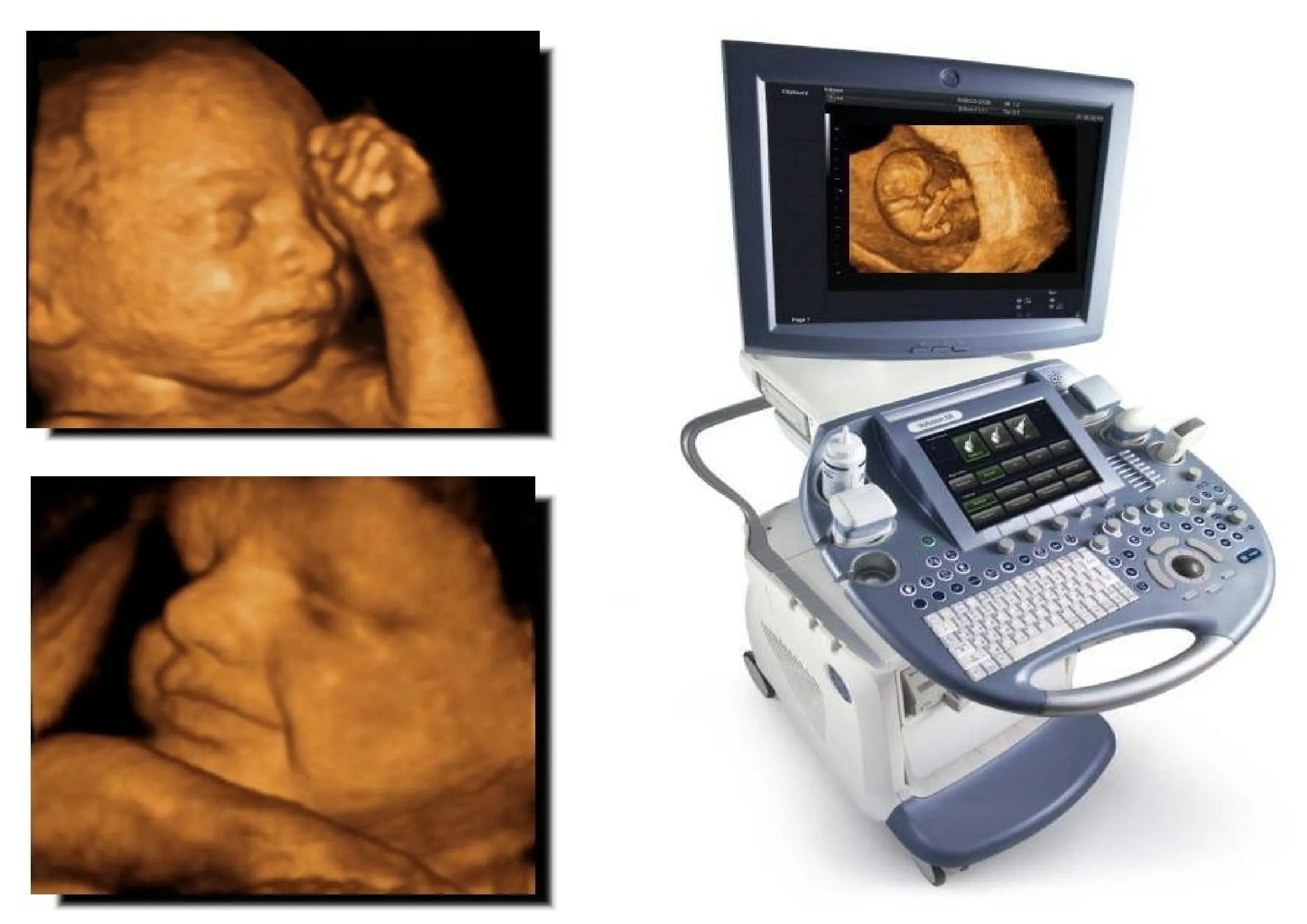 Magzati ultrahang, Medical Center „reproduktív egészség”