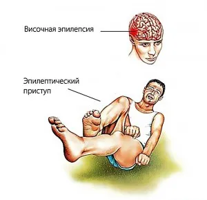 Видове епилепсия основни форми и методи за лечение