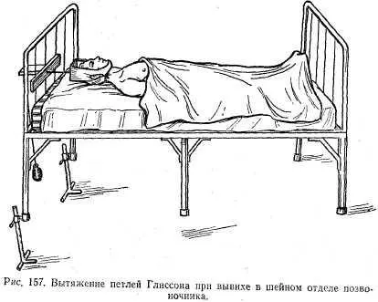 Разместване на лумбалните прешлени (снимка)