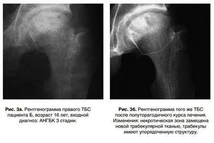 Една възможна алтернатива на тазобедрена става, специализиран център за