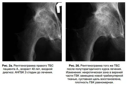 Една възможна алтернатива на тазобедрена става, специализиран център за