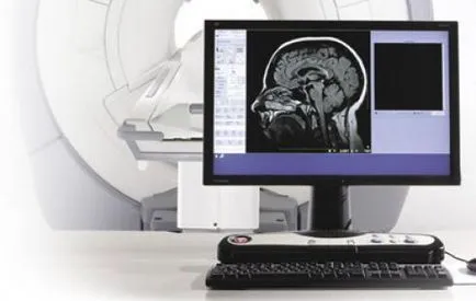 Записване снимки MRI на лента или CD-диск
