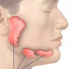 Adenoma a nyálmirigy és tünetek különféle
