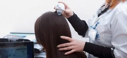 Alopecia la copii cauzele și metodele de eliminare