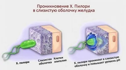 Алкохолът гастрит как да се пие по-добре