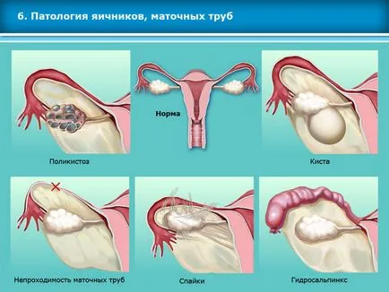 Atlasul tehnicilor de reproducere asistata in tratamentul infertilitatii