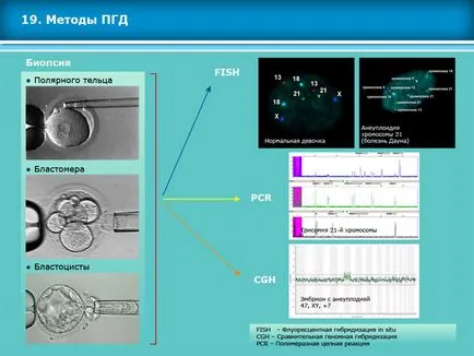 Atlas asszisztált reprodukciós technológiák meddőségi kezelés