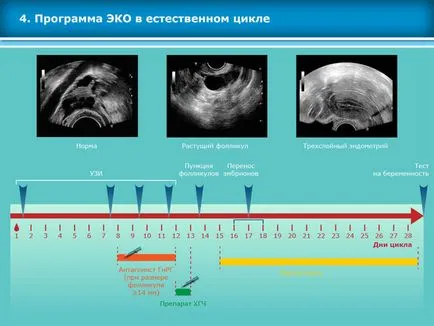 Atlas asszisztált reprodukciós technológiák meddőségi kezelés