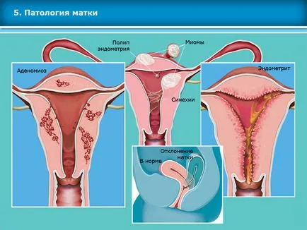 Atlasul tehnicilor de reproducere asistata in tratamentul infertilitatii