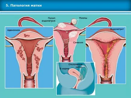 Atlas asszisztált reprodukciós technológiák meddőségi kezelés