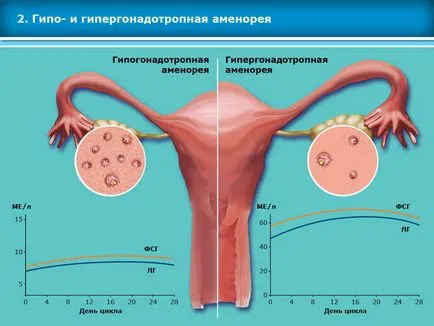 Atlasul tehnicilor de reproducere asistata in tratamentul infertilitatii