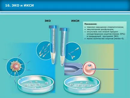 Atlas asszisztált reprodukciós technológiák meddőségi kezelés