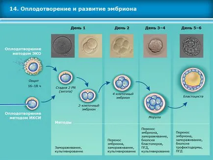 Atlas asszisztált reprodukciós technológiák meddőségi kezelés