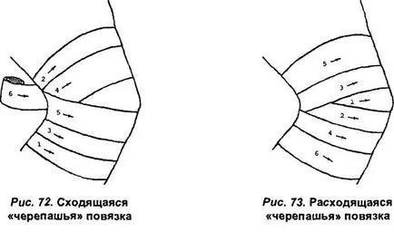 Костенурки превръзка на лакътя