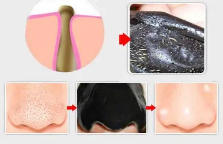 Черно маска филм - най-доброто домашно маска за дълбоко почистване на порите