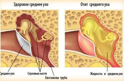 Какво става, ако положи ухото му със студена и резки промени на дъното под налягане