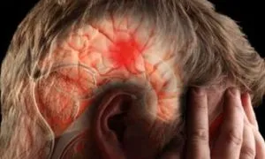 Accident vascular cerebral la barbati si primele semne de ajutor, simptome și tratament