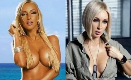 Лера Кудрявцева преди и след снимки на пластмаса
