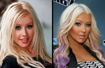 Любими звезди преди и след пластична на известни личности, които променят външния си вид (снимки)