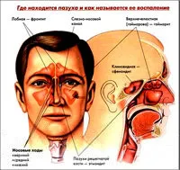 Klinikán cryo - méz - orrmelléküreg-gyulladás