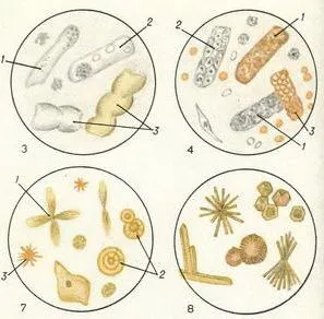 Examinarea microscopică a sedimentul urinar