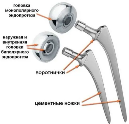 цервикален хип лечение фрактура, симптоми и първа помощ