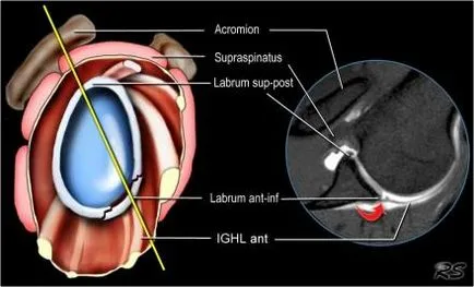 Umăr anatomie studiu comun folosind IRM